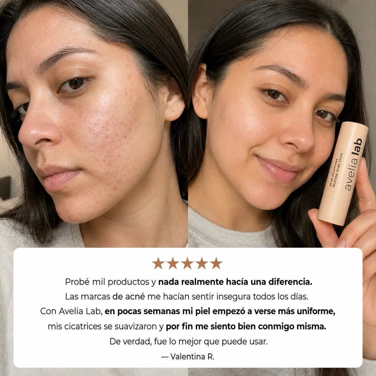Skin Restore™ | Elimina las cicatrices en 7 días