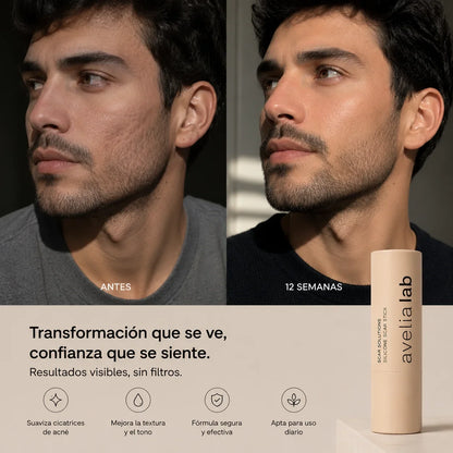 Skin Restore™ | Elimina las cicatrices en 7 días