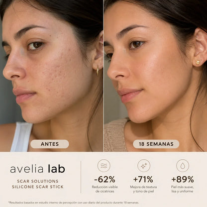 Skin Restore™ | Elimina las cicatrices en 7 días